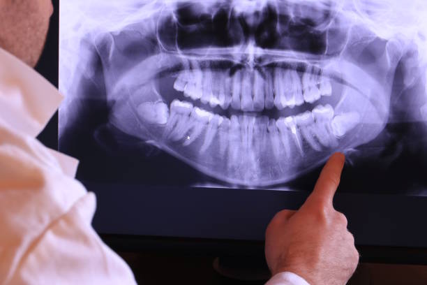 Best Emergency Treatment for Toothache in Oregon, IL