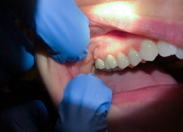 Best Walk-In Emergency Dentist in Oregon, IL