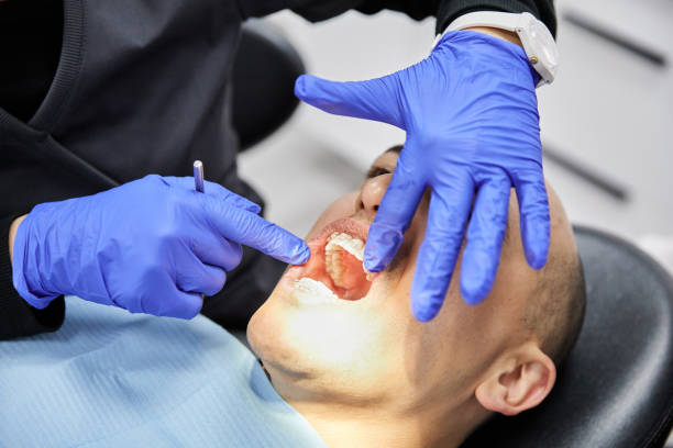 Best Emergency Tooth Extraction in Oregon, IL